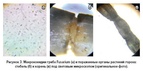 Рис.3 Макроконидии гриба Fusarium